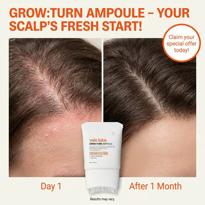 Vale labs —  Hair Growth Protocol.