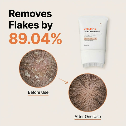 Vale labs —  Hair Growth Protocol.