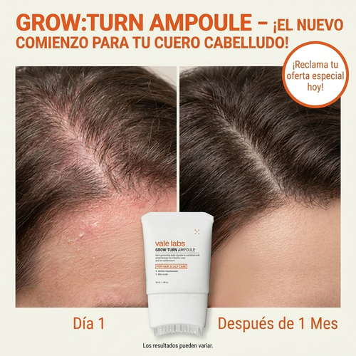 Vale Hair Growth - Protocolo para  el Crecimiento Cabello