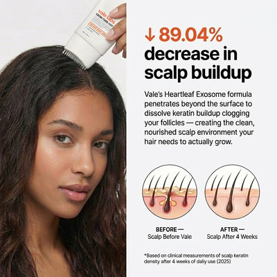 Vale labs —  Hair Growth Protocol.